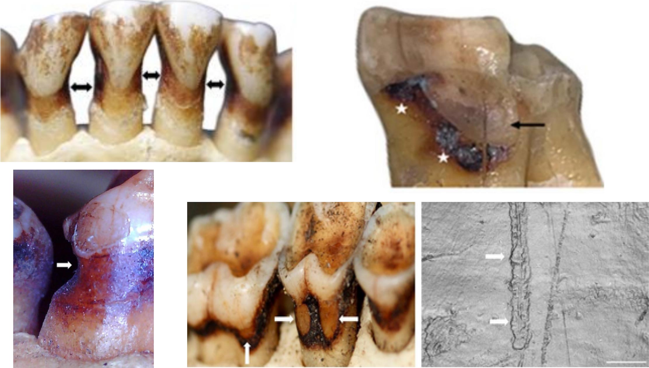 Root Lesions in Wild Primate Teeth