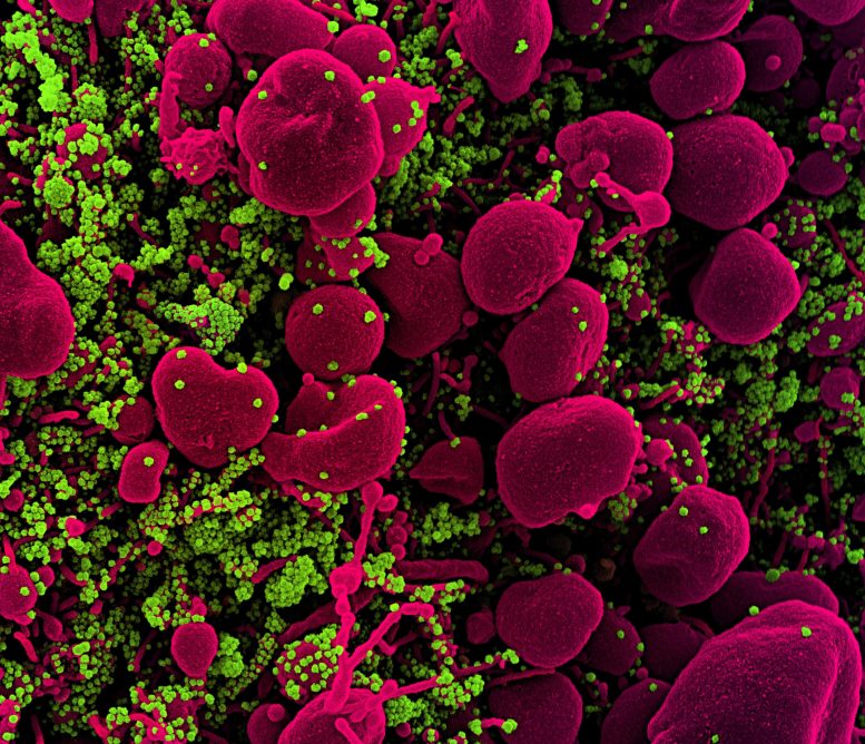 SARS-COV-2 Virus Colorized Scanning Electron Micrograph