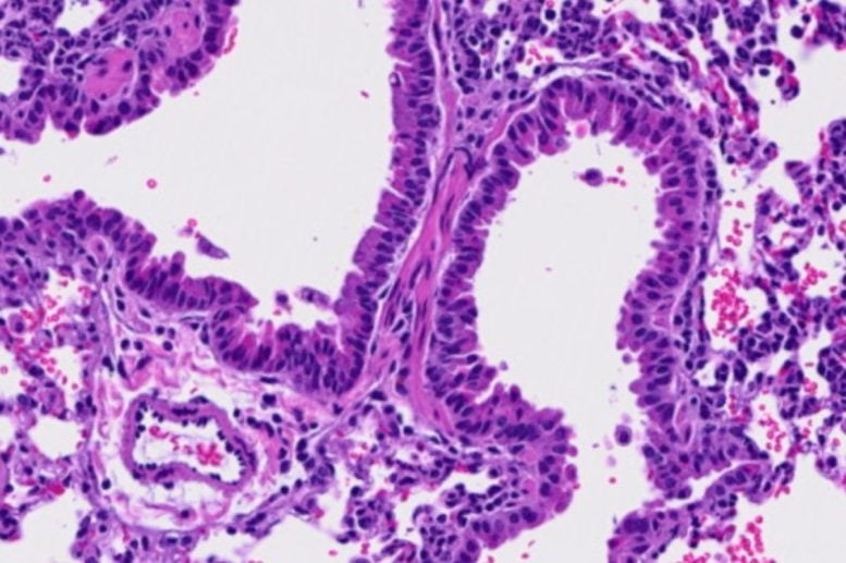 This Common Amino Acid May Help the Body Fight Cancer and Viruses