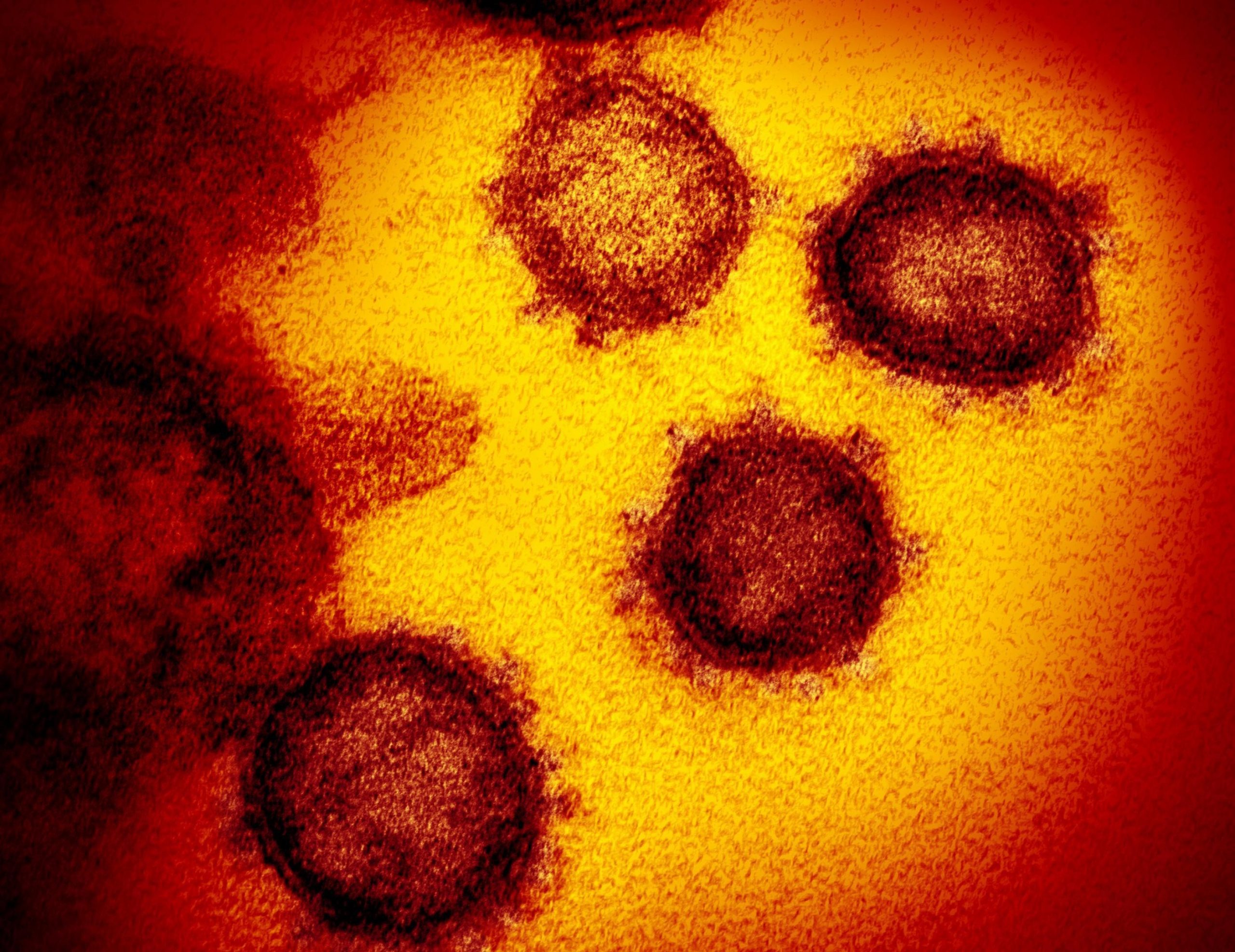 New coronavirus circulates undetected months before first COVID-19 cases discovered in Wuhan, China