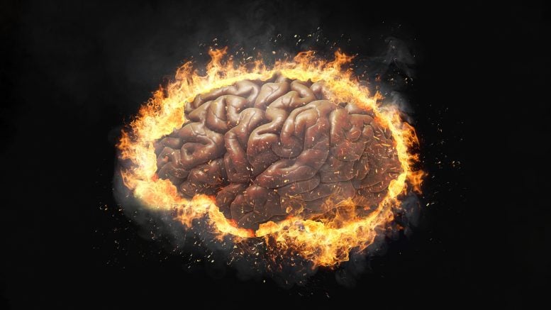 SD Brain on Fire