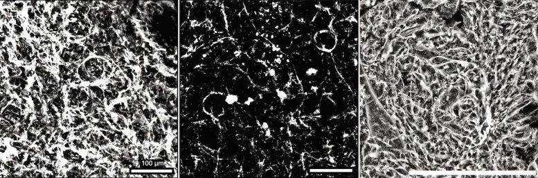 SGLT2 Inhibitors Maintain Youthful Capillaries