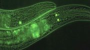 SKN-1B Tagged With GFP