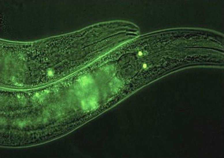 SKN-1B Tagged With GFP