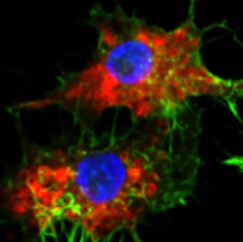 SNAs Taken Up Into Leukemia Cells