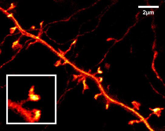 STED image of a nerve cell in the upper brain