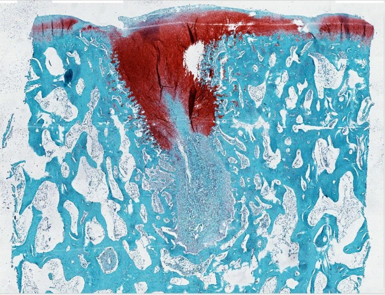 Safranin Treated Cartilage