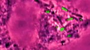 Salmonella Bacteria Engulfed by Macrophage
