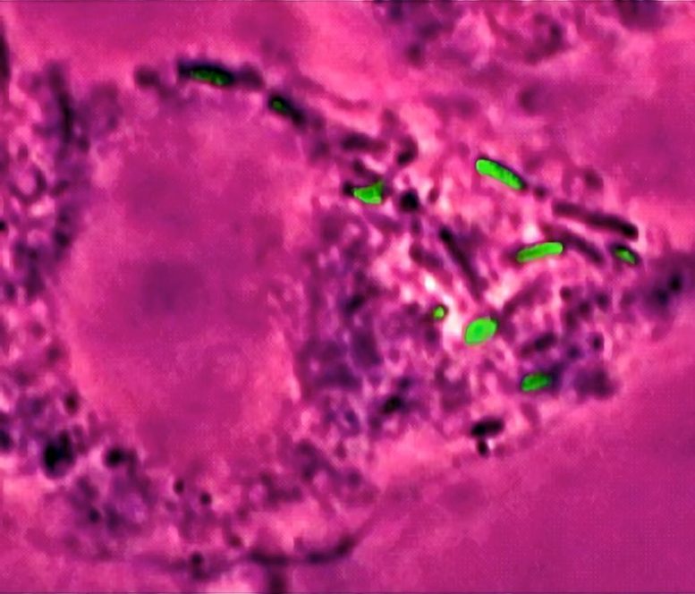 Salmonella Bacteria Engulfed by Macrophage