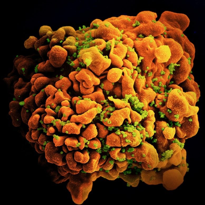Scanning Electron Micrograph of HIV-Infected H9 T Cell