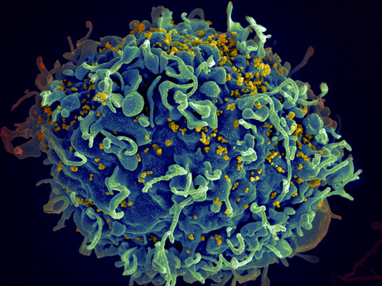 Scanning electron micrograph of HIV particles