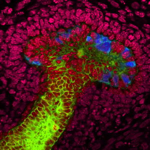 Scientists Grow Kidney Structures from Human Stem Cells
