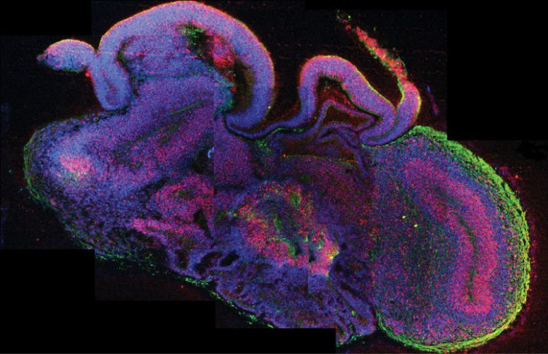 Scientists Succeed in Growing Human Brain Tissue