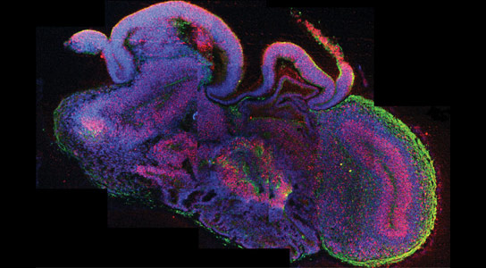 Scientists Succeed in Growing Human Brain Tissue in a 3D Culture System