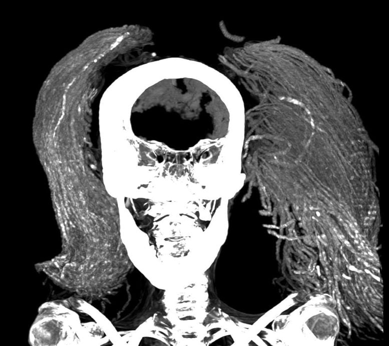 Screaming woman, mummy scan