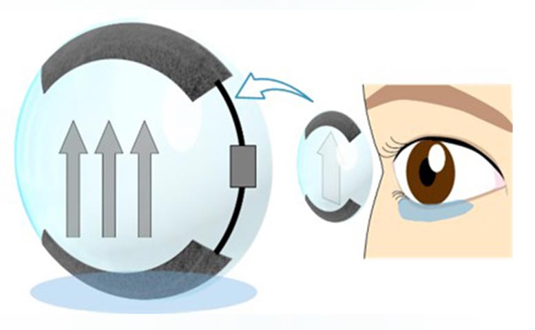 A Deadly Mistake Uncovered On Lens And Learn How To Avoid It