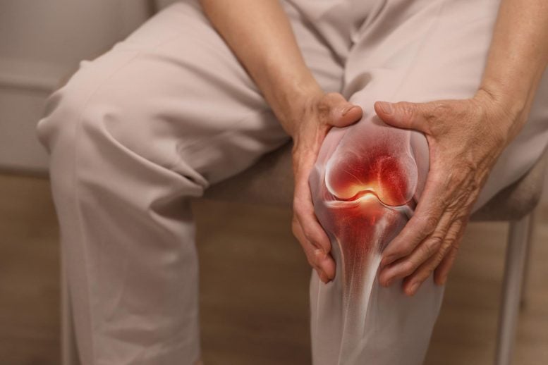 Why Most Knee X-Rays Do More Harm Than Good