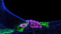 Sensory Hair Cells Newborn Mouse Cochlea