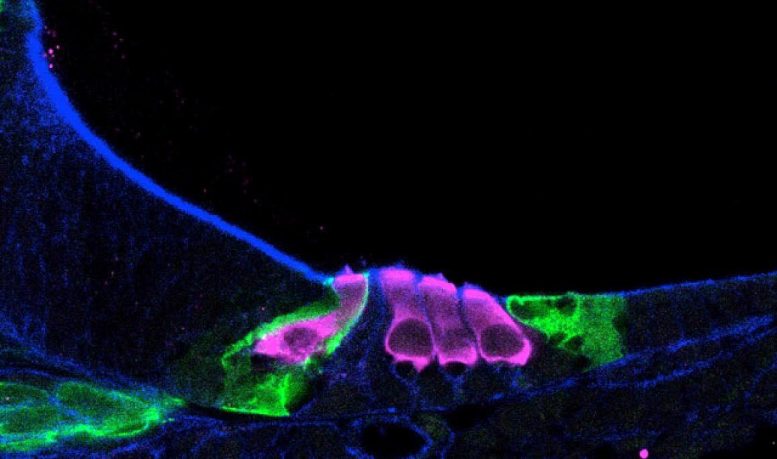 Sensory Hair Cells Newborn Mouse Cochlea