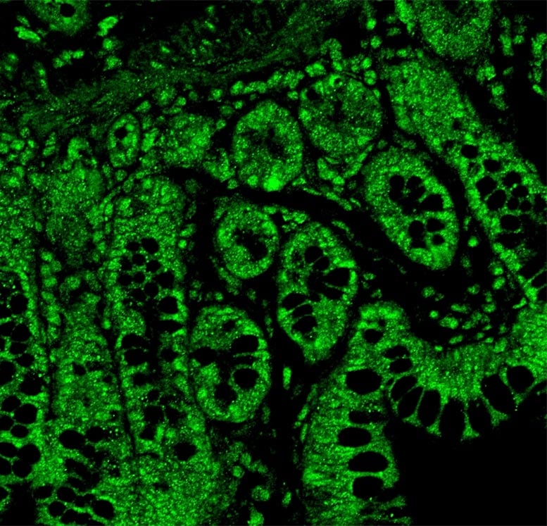 Serotonin Receptors in Gut