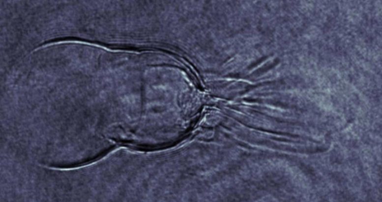 Shadowgraphy Plasma