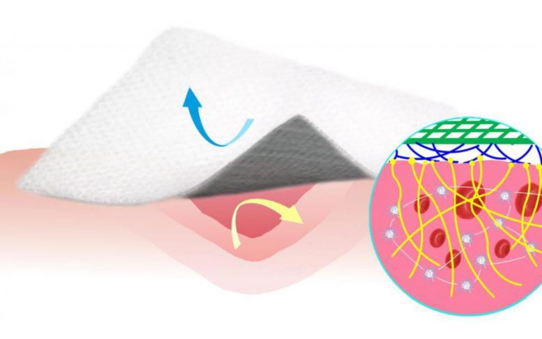 Silicone and Carbon Nanofiber Coated Bandage