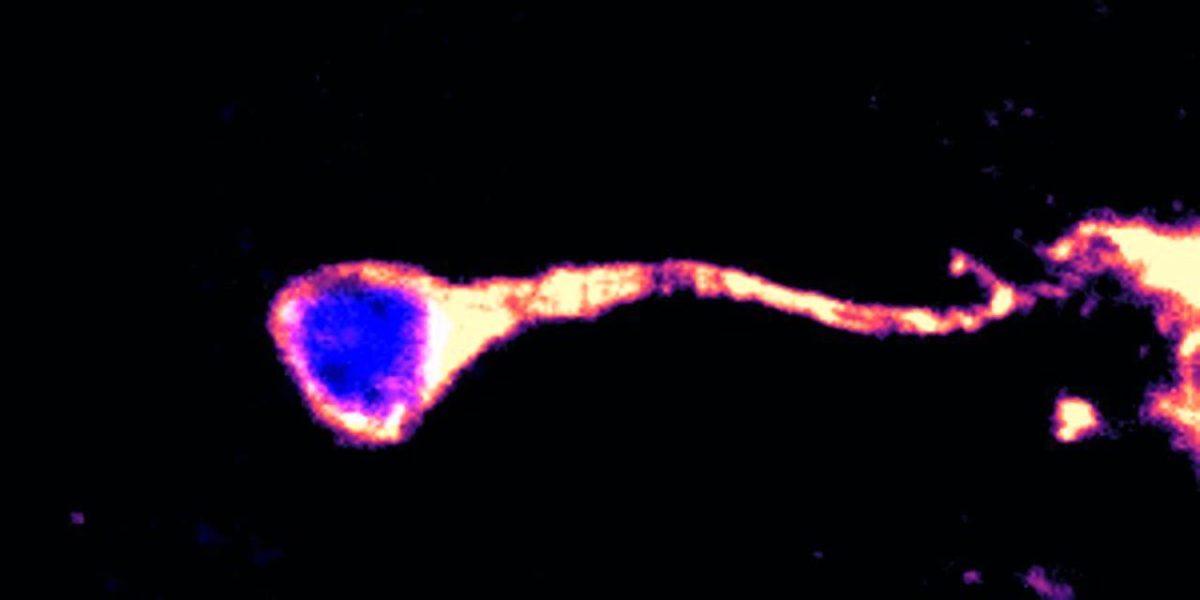 Could This Protein Hold the Key to Reversing Brain Aging and Repairing ...