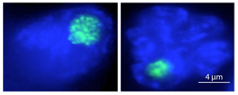 Size of the Nucleolus Plays Important Role