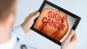 Skin Cancer App Illustration