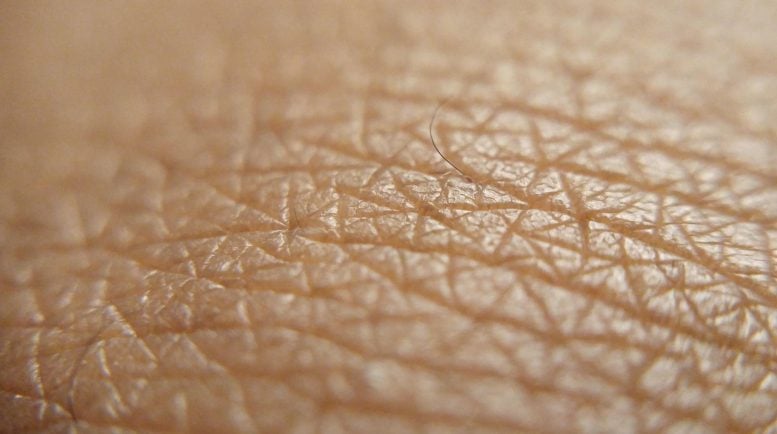 ¿Por qué la piel se vuelve “correosa” después de exponerse demasiado al sol?  Una nueva investigación arroja luz