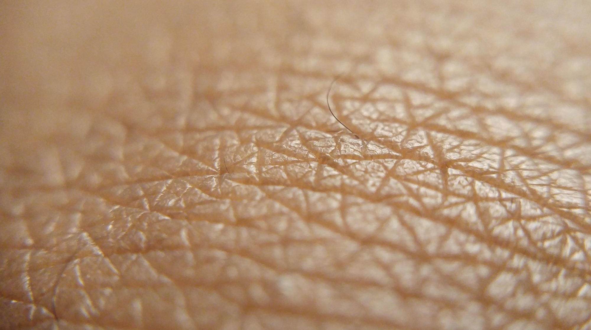 ¿Por qué la piel se vuelve «correosa» después de exponerse demasiado al sol?  Una nueva investigación arroja luz