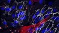 Skin Fibroblasts Reprogrammed