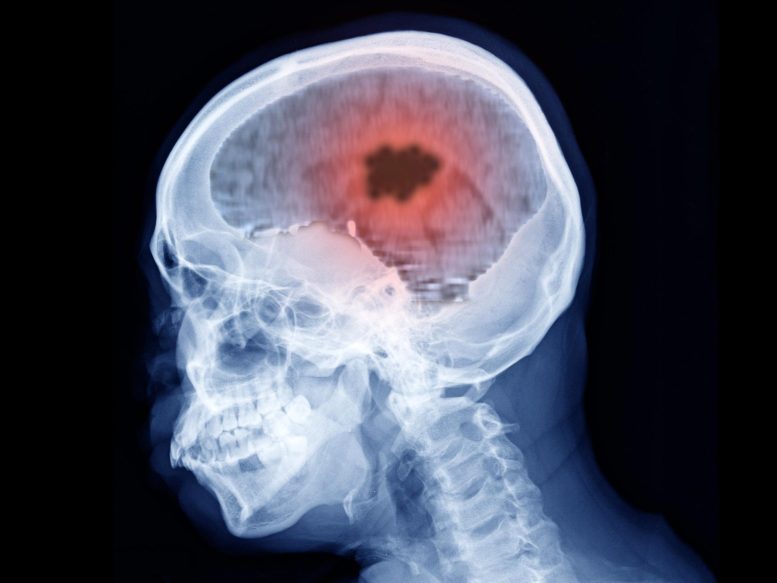 Skull Brain Scan