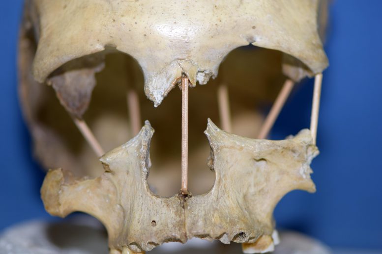 Skull of Peştera Muierii 1