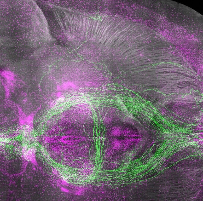 Sleep Promoting Neurons