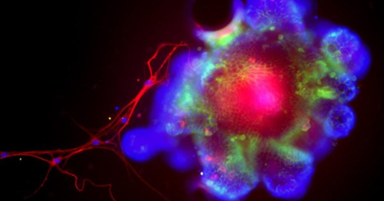 Scientists Find the Protein That Lets Alcohol Wreck Your Liver