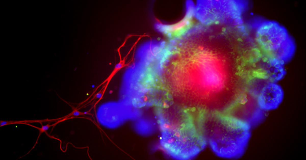 Scientists Find the Protein That Lets Alcohol Wreck Your Liver