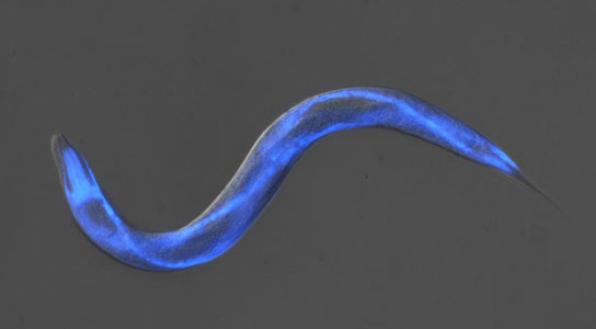 Small Worm May Help the Fight Against Alzheimers