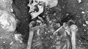 Smallpox-Infected Viking Skeleton