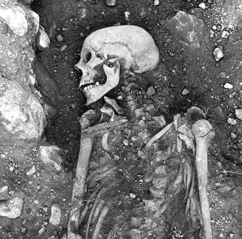 Smallpox-Infected Viking Skeleton