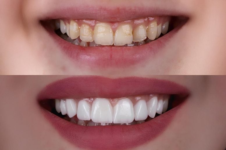 The Crown Jewel of Dentistry? Breakthrough Tech Could Transform Tooth Repair