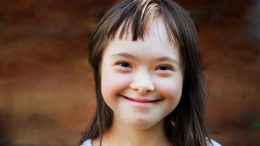 Smiling Girl Downs Syndrome