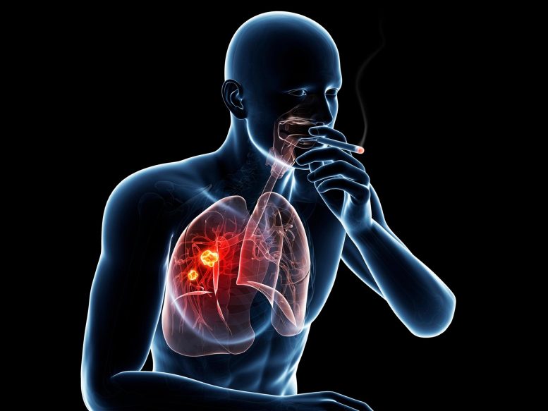 Smoking Lung Cancer Illustration