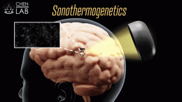 Sonothermogenetics Brain Stimulation