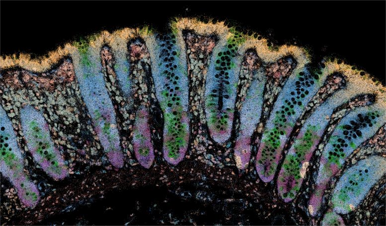 Spatial Transcriptomics of IBD Gut Tissue