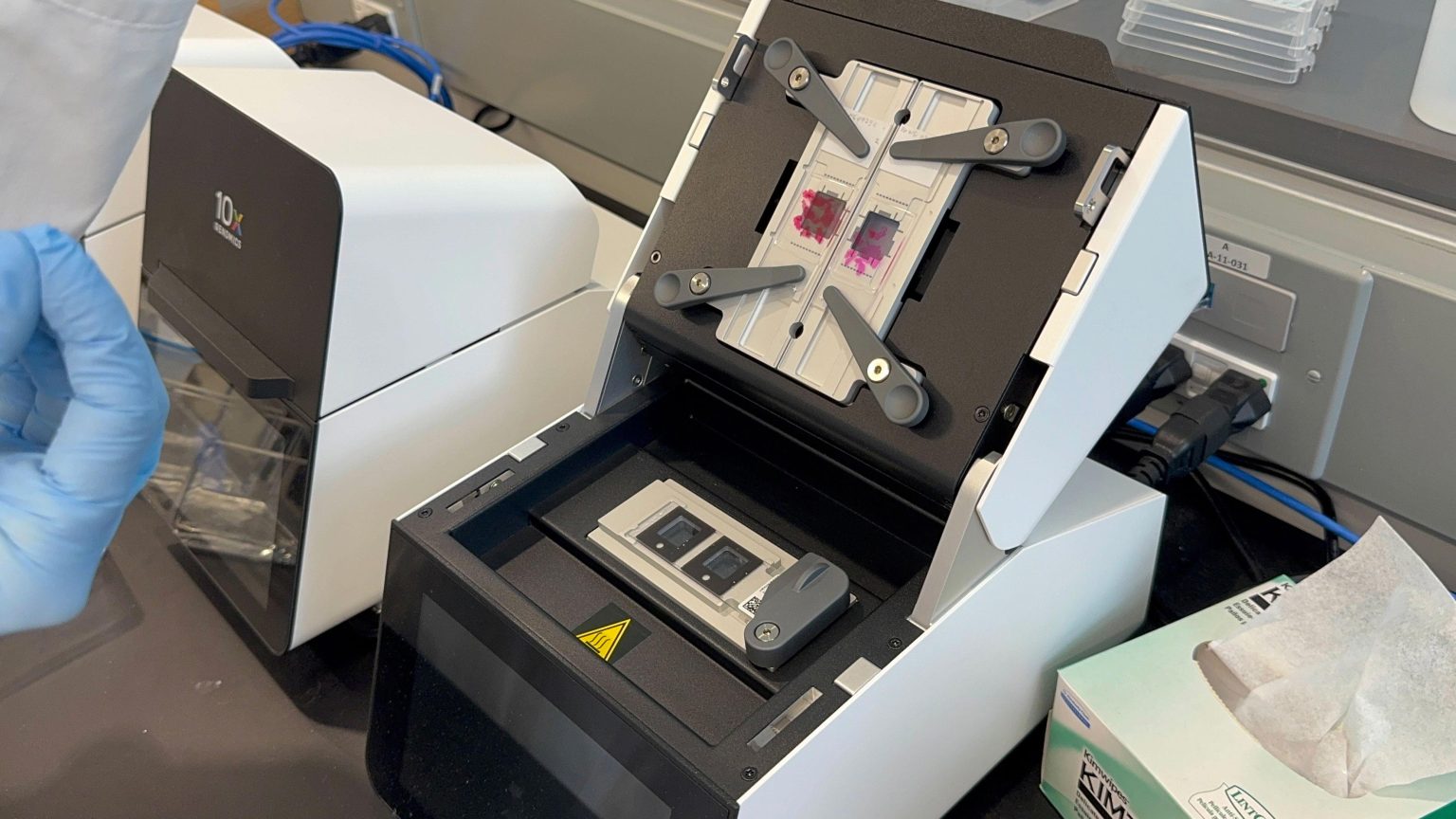 Scientists Discover How To Flip the Immune “Switch” Against Alzheimer’s ...