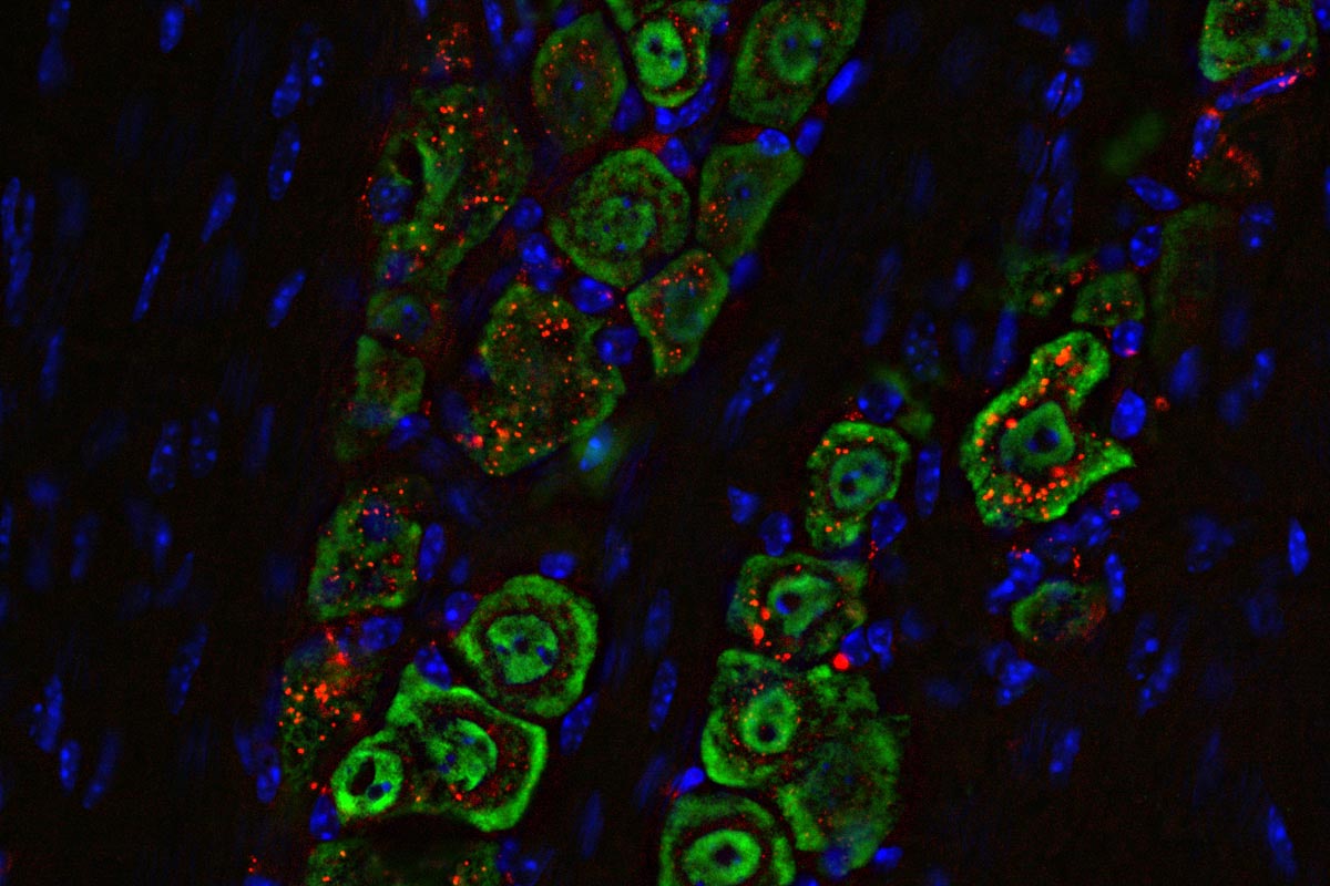 Image 1 for Scientists develop nasal drops that wipe out aggressive brain tumors in mice
