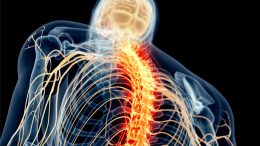 Spinal Cord Nerve Pain Illustration