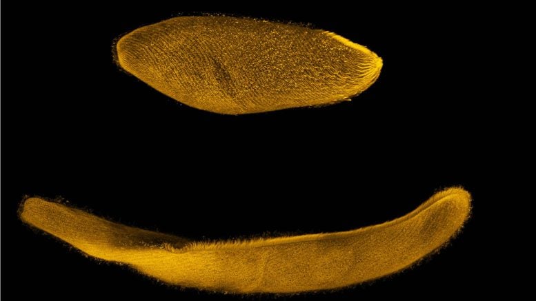 Spirostomum ambiguum