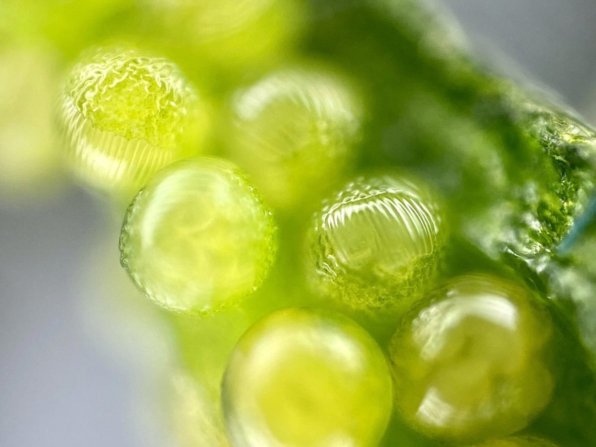 Bacterial Invasion: How One Pathogen Threatens Every Plant on Earth